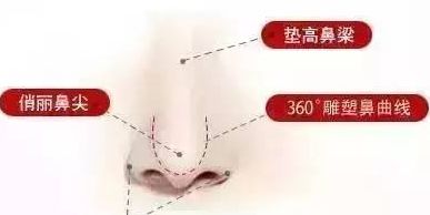 鼻小柱延長(zhǎng).jpg