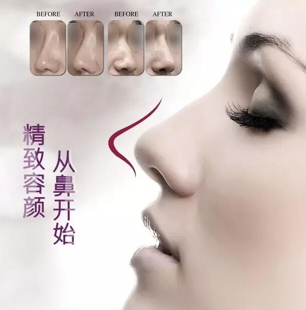 精致容顏，從鼻開始