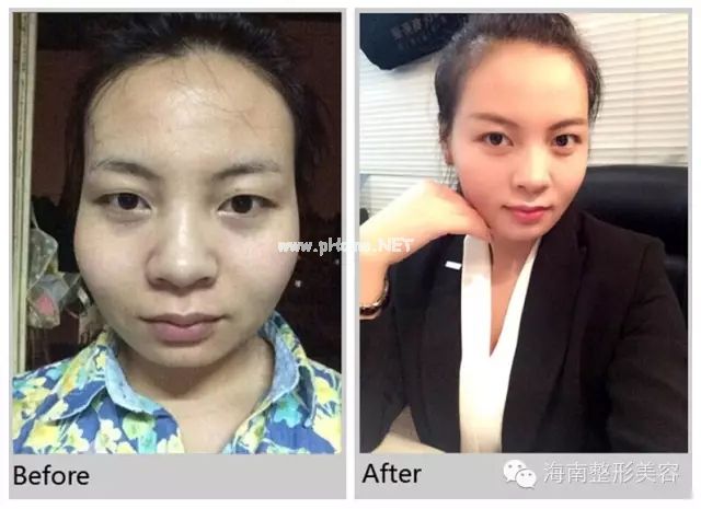 林蔚茜博士手術(shù)案例