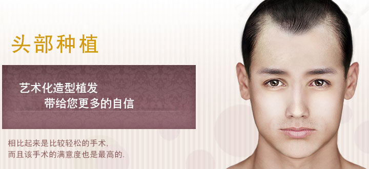 植發(fā).jpg