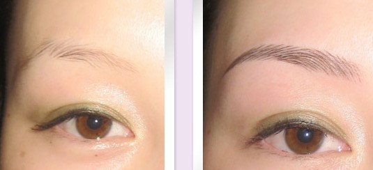 仿生植眉——張小姐