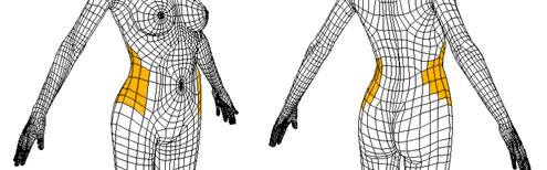 腰部吸脂-林賢超