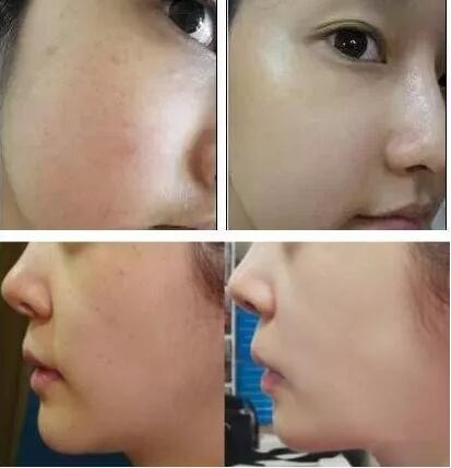 情人節(jié)活動(dòng)-海南整形5