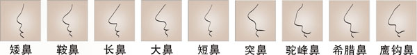 東方人常見(jiàn)缺陷鼻型